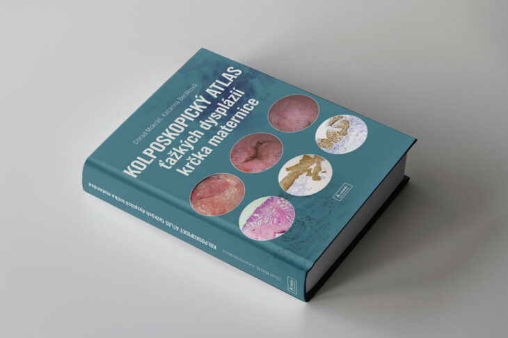 koplo-book_cover_mockup koplo-book_cover_mockup